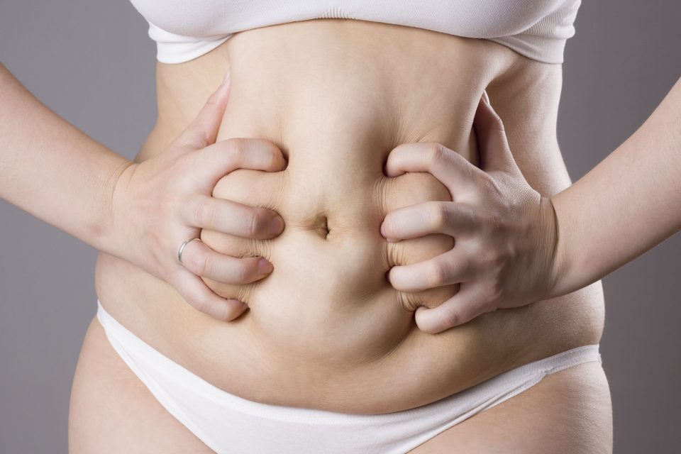 Wycięcie nadmiaru fałdów skórnych z tkanka tłuszczową, czyli abdominoplastyka Gdańsk