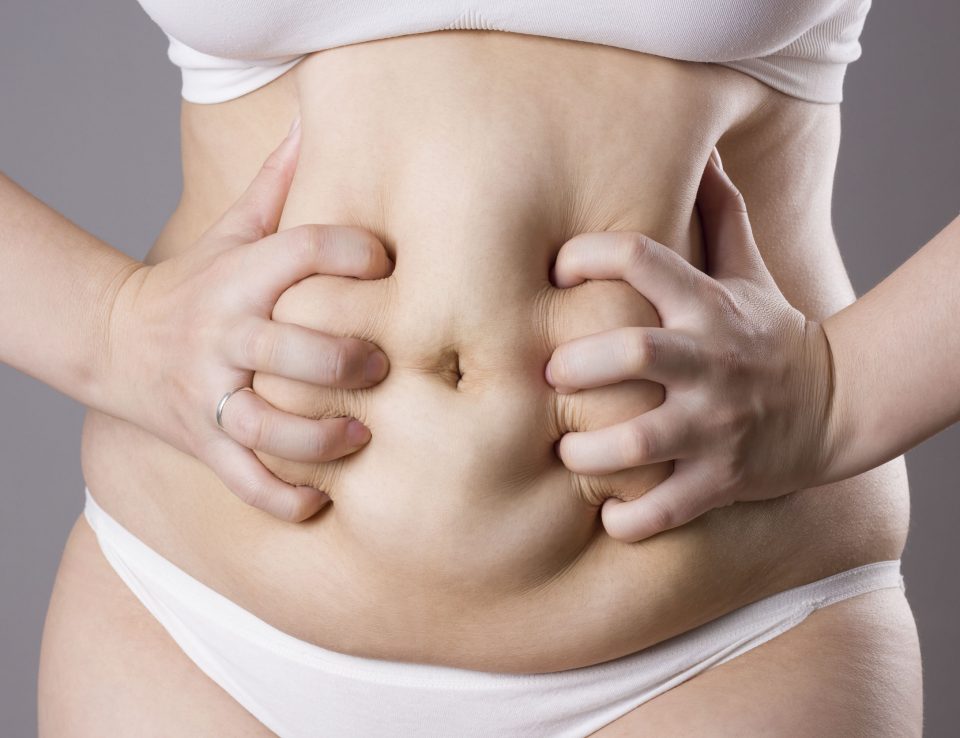 Wycięcie nadmiaru fałdów skórnych z tkanka tłuszczową, czyli abdominoplastyka Gdańsk